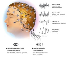 Electroencephalogram