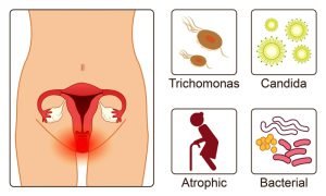 Types of vaginitis