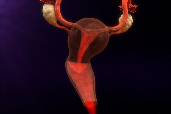 Endometrial Cancer Classification: Types of Endometrial Cancer