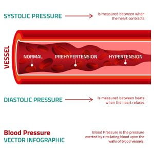 Blood Pressure - Systolic and Diastolic