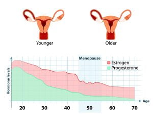 Menopause