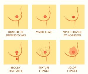 Breast cancer symptoms