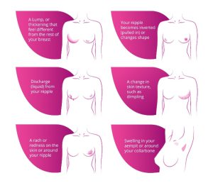 How do I check my breasts for breast cancer?