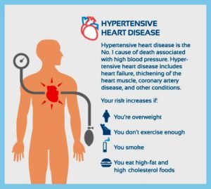 Hypertensive heart disease risks