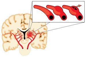 Blood vessels of brain