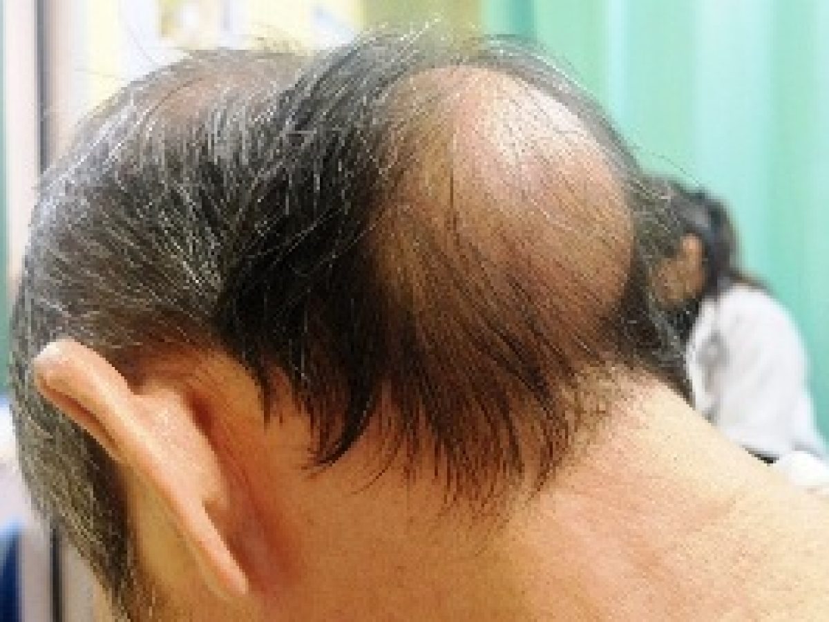 Lumps and Bumps on Head: Causes. Treatment Lumps and Bumps on Head: Causes. Treatment