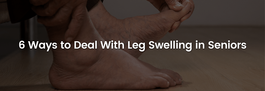 Leg Swelling Seniors