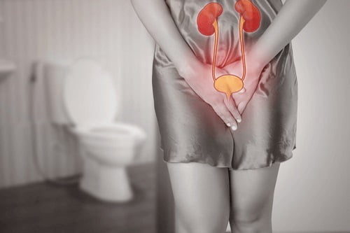 A woman has pain during urination