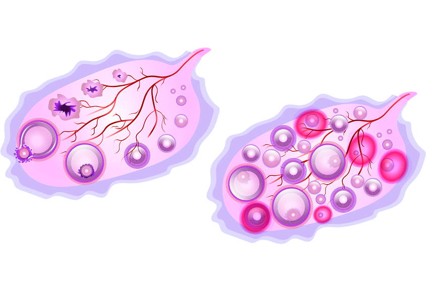 Age and Fertility