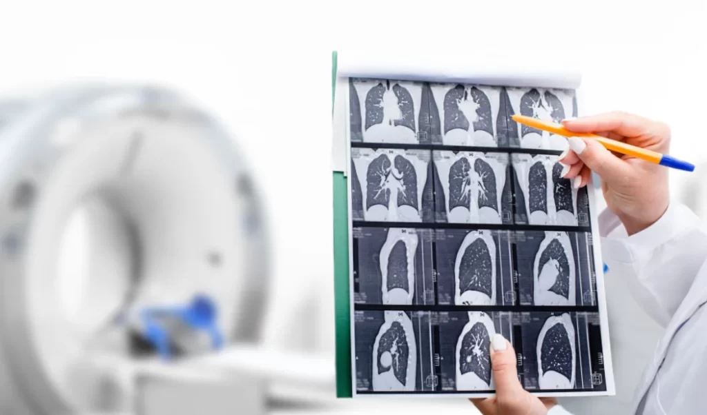 CT Scan