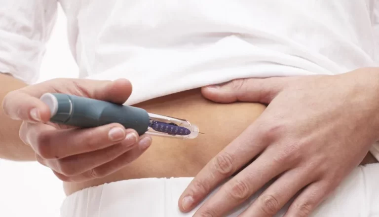 Ectopic Pregnancy