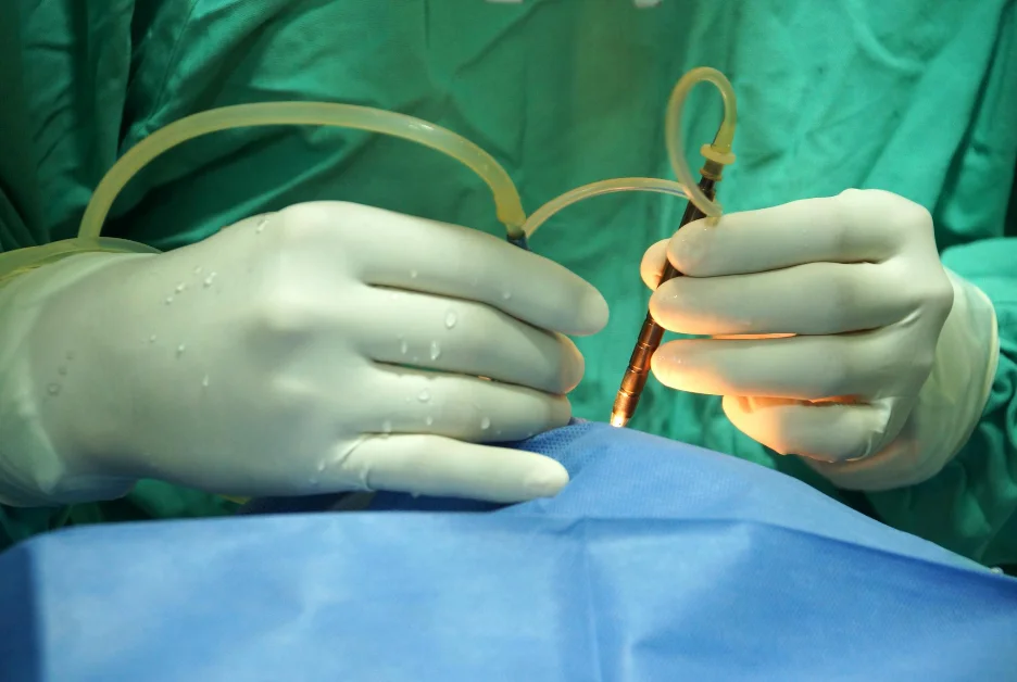 A doctor in surgical gloves holding a tube