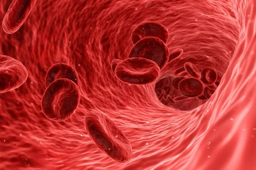 Carotid Stenosis ICD-10