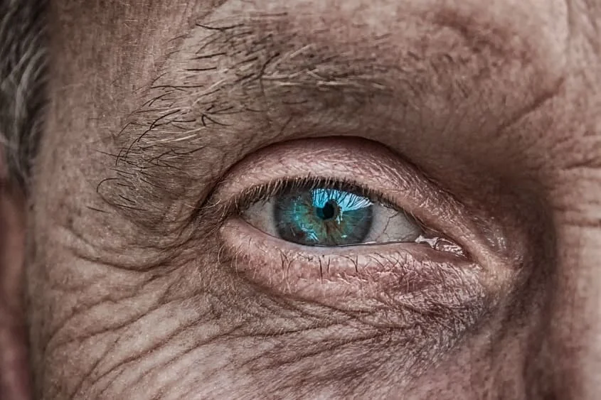 Dry Eyes ICD-10