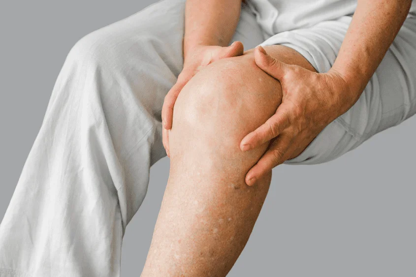 Lymphedema ICD-10