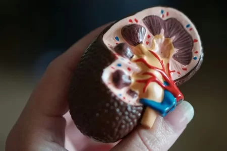 kidney stone icd 10