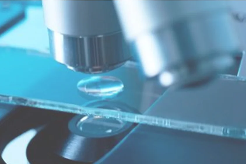 Kidney Stone Under Microscope Unveiling Microscopic Insights