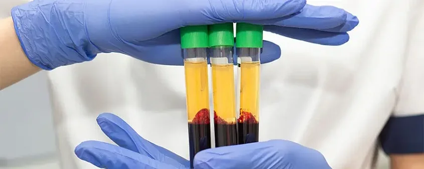 P-Shot Procedure