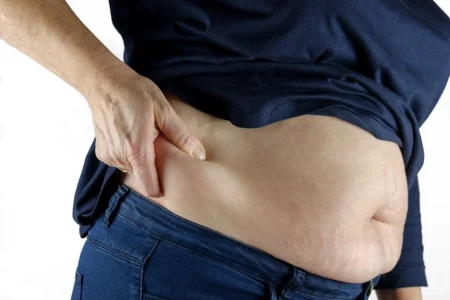 Bariatric Surgery in Tennessee