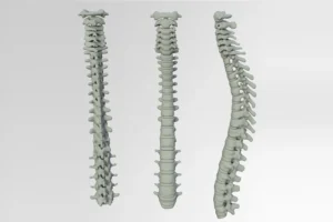 mental stress and back pain