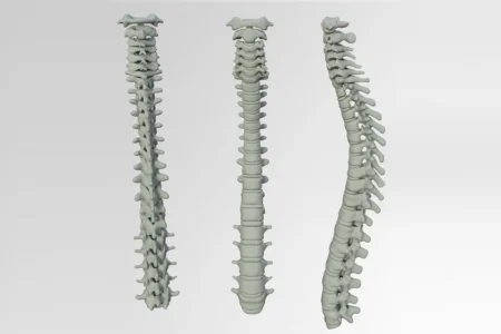 mental stress and back pain