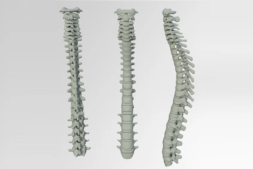 mental stress and back pain