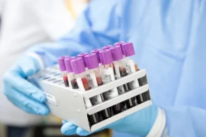Why Do Labs Take So Much Blood
