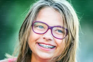 Best Age to Get Braces for Kids