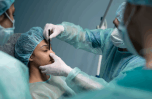 Almond Eye Surgery: What Is It and What Can You Expect?