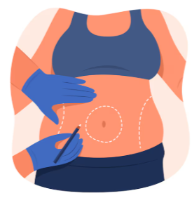 Liposuction Vs Gynecomastia Surgery A Simple Comparison