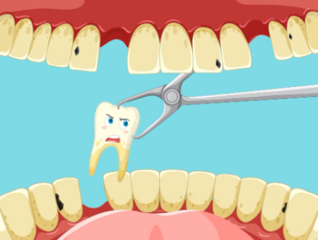 repairing a chipped tooth using dental bonding in a modern clinic.