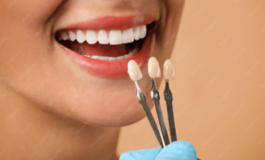 Cosmetic dentist examining porcelain dental veneers and explaining enamel preparation