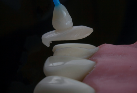 New Low-Key But Game-Changing Dental Technologies Modern dental clinic using AI diagnostics, intraoral scanners, and advanced dental technology for patient care