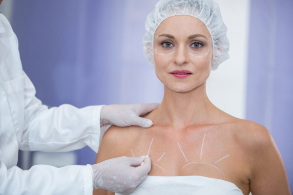 A doctor is marking female patient body for breast surgery