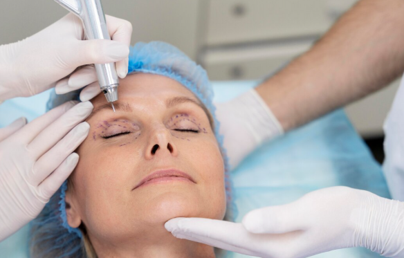 Plastic surgeon performing on a patient with drooping eyelids, blepharoplasty treatment options.