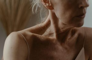 How Aging Affects Collagen Production and Skin Elasticity Close-up of mature facial skin showing reduced elasticity and fine lines caused by natural collagen loss.