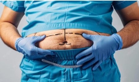 a doctor preparing for plastic surgery after weight loss in a person