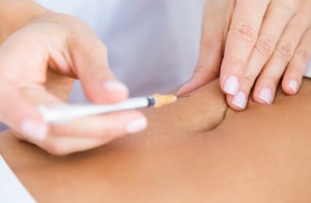Plastic surgeon examining a patient's surgical scar during a consultation to discuss scar revision treatment options.