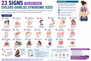 Infographic highlighting 23 possible signs associated with Ehlers-Danlos syndrome (EDS), including unusual flexibility, joint instability, recurrent sprains, easy bruising, stretchy or soft skin, abnormal scarring, fatigue, headaches, digestive and pelvic symptoms, and family history. The infographic emphasizes that these signs are not diagnostic and encourages professional evaluation.