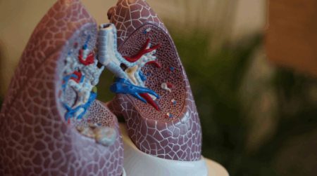 chronic cough and shortness of breath associated with a long-term health condition.