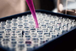 Evaluating Performance Supplements: Clinical Insights into Efficacy and Potential Adverse Effects Testing of Performance supplements including protein powder and sports nutrition products.