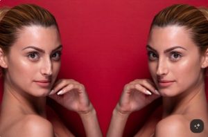 Facial rejuvenation illustration showing natural cheek, jawline, and neck contours