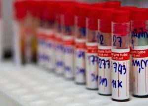 Shelf Life of Lab Reagents: Why Synthetic Urine Formulations Degrade Over Time Laboratory reagent container used for synthetic urine stability testing