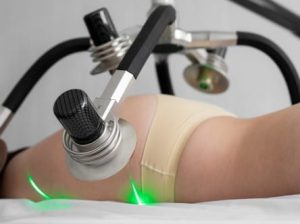 Non-surgical body contouring treatment